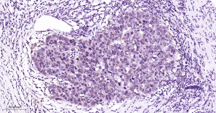 丝裂原活化蛋白激酶p38α重组兔单抗