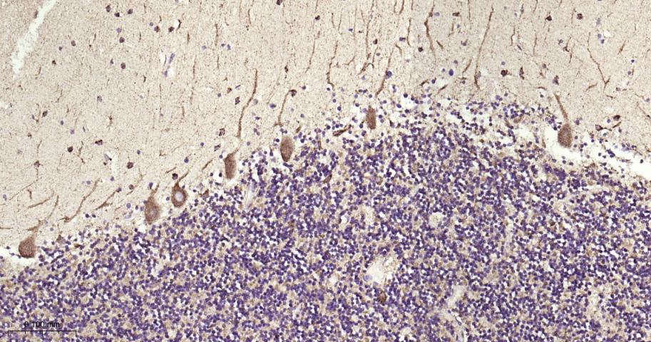 铁调节蛋白2重组兔单抗