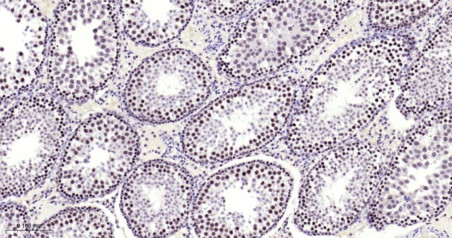 甲基转移酶样蛋白3重组兔单抗