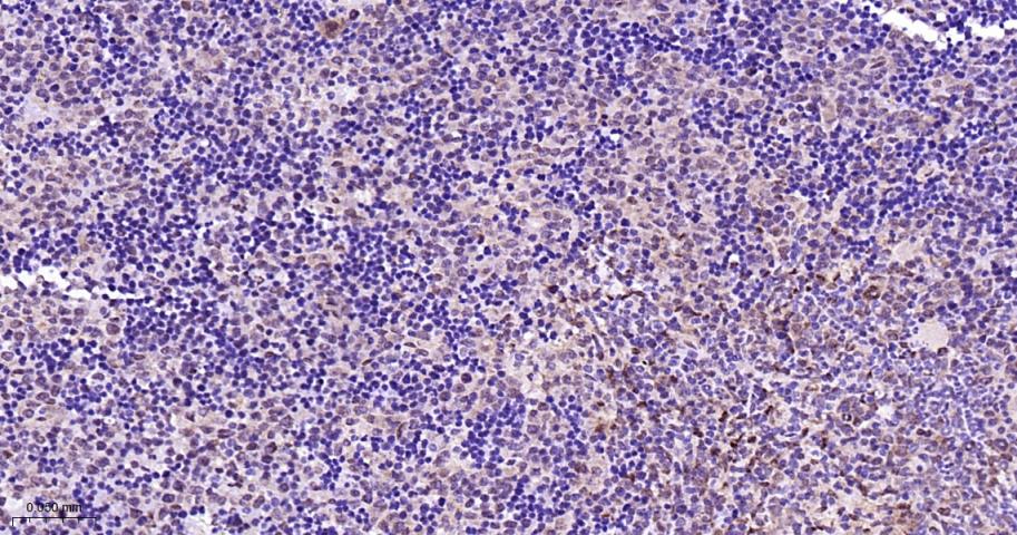 丝裂原活化蛋白激酶p38α重组兔单抗