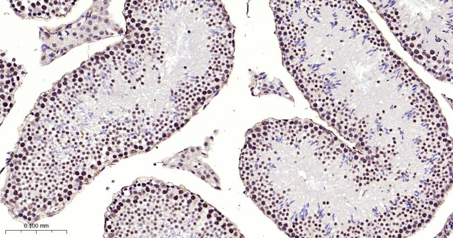 甲基转移酶样蛋白3重组兔单抗