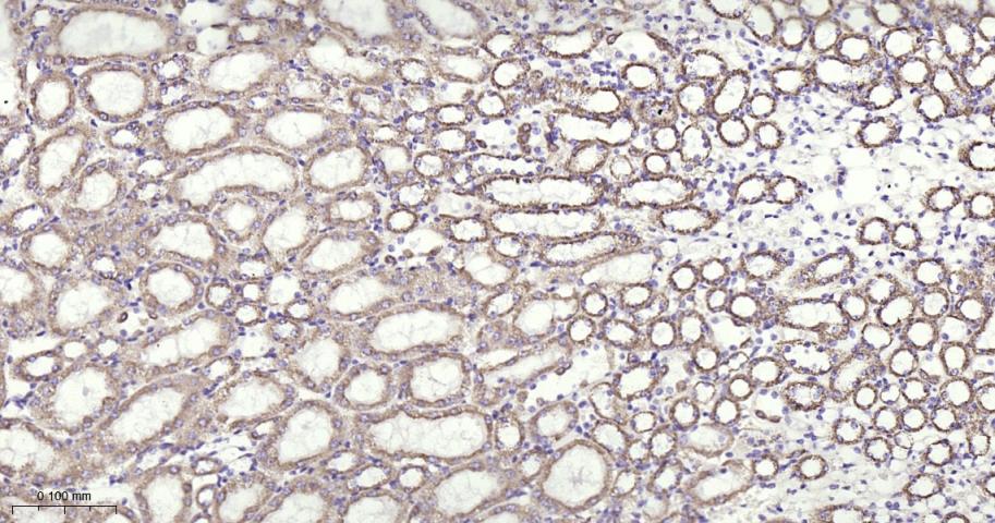铁调节蛋白2重组兔单抗
