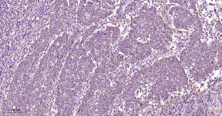 等电压依赖性阴离子通道（内参）重组兔单抗