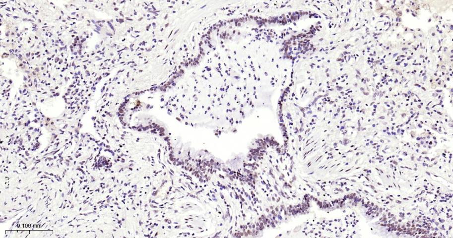 甲基转移酶样蛋白3重组兔单抗