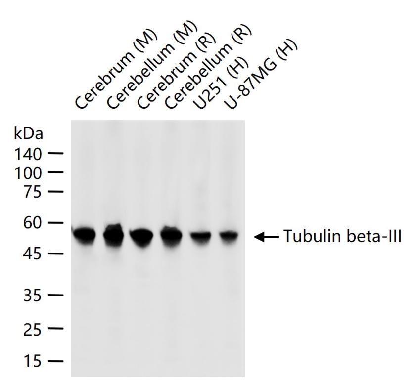 微管蛋白β3重组兔单抗