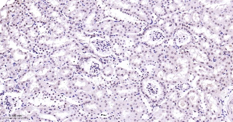 丝裂原活化蛋白激酶p38α重组兔单抗