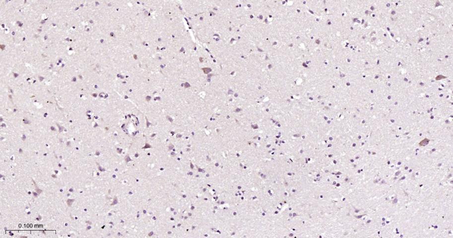 细胞信号转导分子Smad-1重组兔单抗