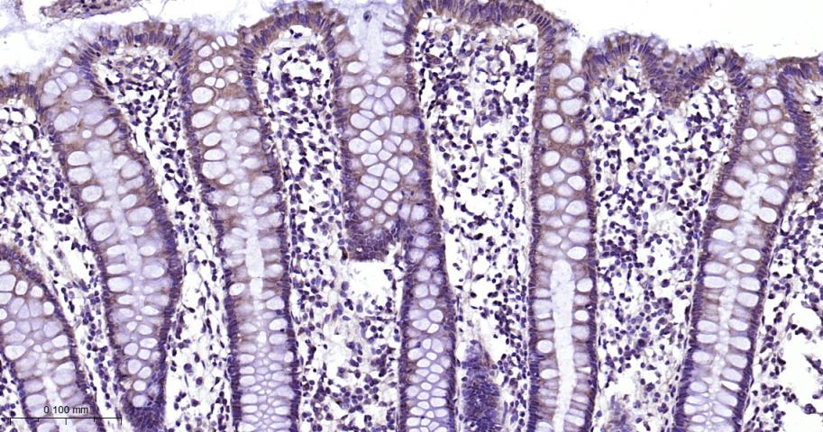 细胞信号转导分子Smad-1重组兔单抗