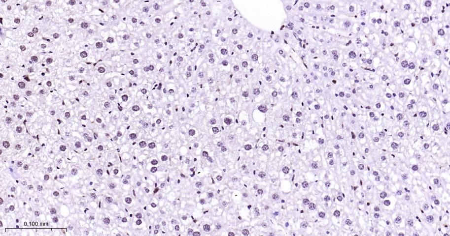 丝裂原活化蛋白激酶p38α重组兔单抗