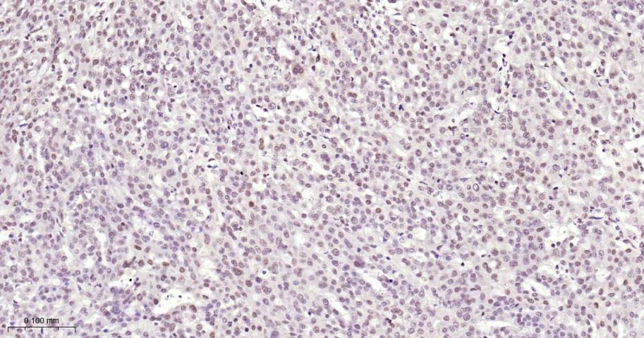 甲基转移酶样蛋白3重组兔单抗