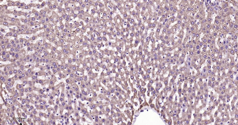 等电压依赖性阴离子通道（内参）重组兔单抗
