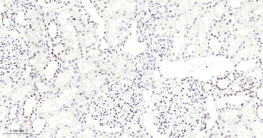 甲基转移酶样蛋白3重组兔单抗