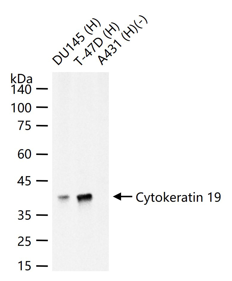 Cytokeratin 19 Mouse mAb (一抗) - WB,IHC-P,IHC-F,IF,ICC/IF | Bioss