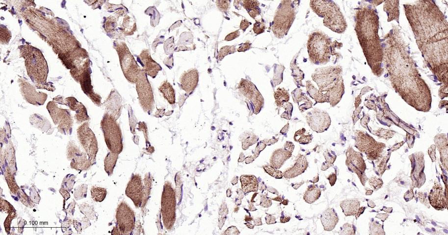 自噬相关蛋白4C重组兔单抗-bsm-61516R