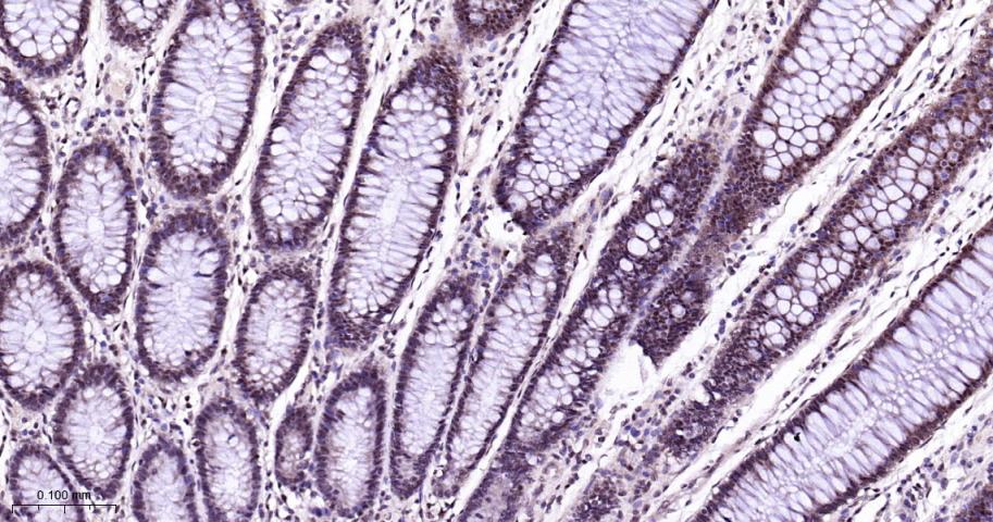 丝裂原活化蛋白激酶p38α重组兔单抗