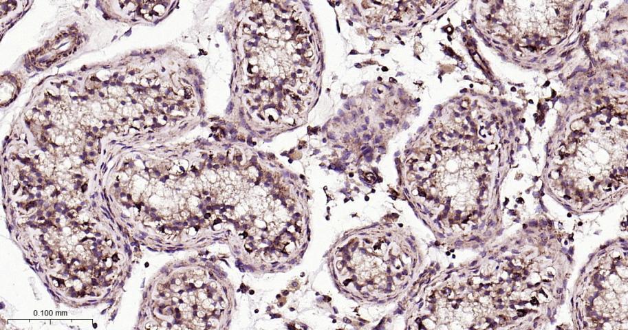 自噬相关蛋白4C重组兔单抗-bsm-61516R