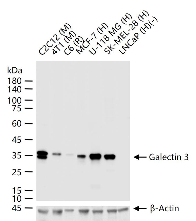 Galectin 3 Rabbit pAb (一抗) - WB,IHC-P,IHC-F,IF,ICC/IF | Bioss