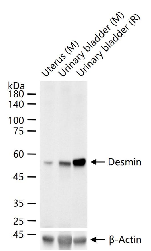 Desmin Mouse mAb (一抗) - WB,IHC-P,IHC-F,IF | Bioss