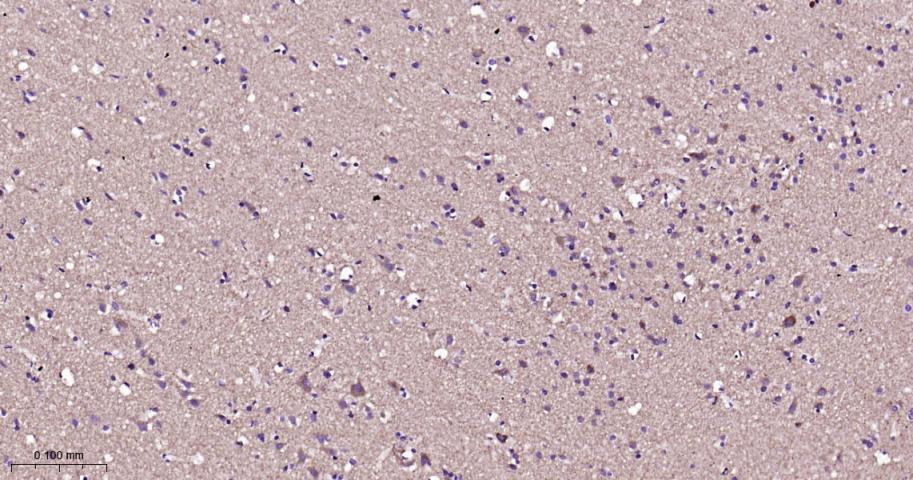 等电压依赖性阴离子通道（内参）重组兔单抗