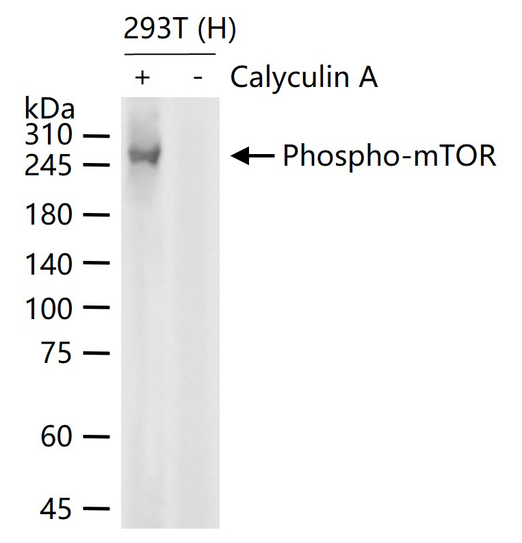 磷酸化雷帕霉素靶蛋白重组兔单抗