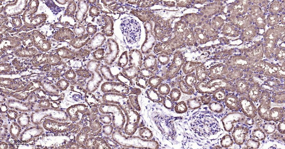 等电压依赖性阴离子通道（内参）重组兔单抗