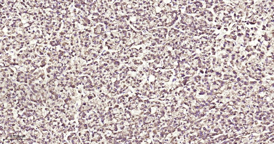 铁调节蛋白2重组兔单抗