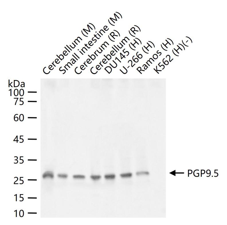PGP9.5 Rabbit pAb (一抗) - WB,ICC/IF | Bioss