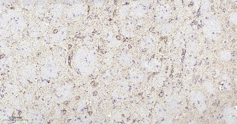 铁调节蛋白2重组兔单抗