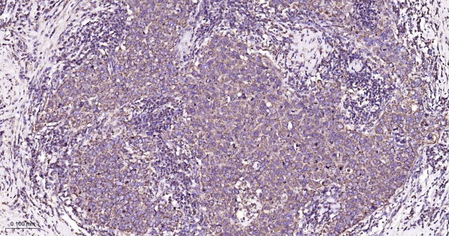 等电压依赖性阴离子通道（内参）重组兔单抗