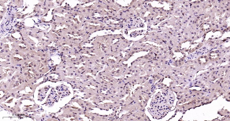 p38 MAPK重组兔单抗