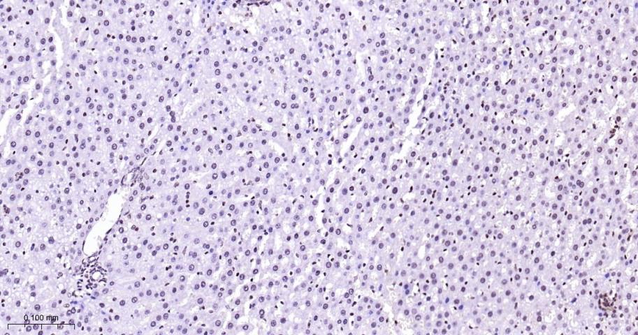 丝裂原活化蛋白激酶p38α重组兔单抗