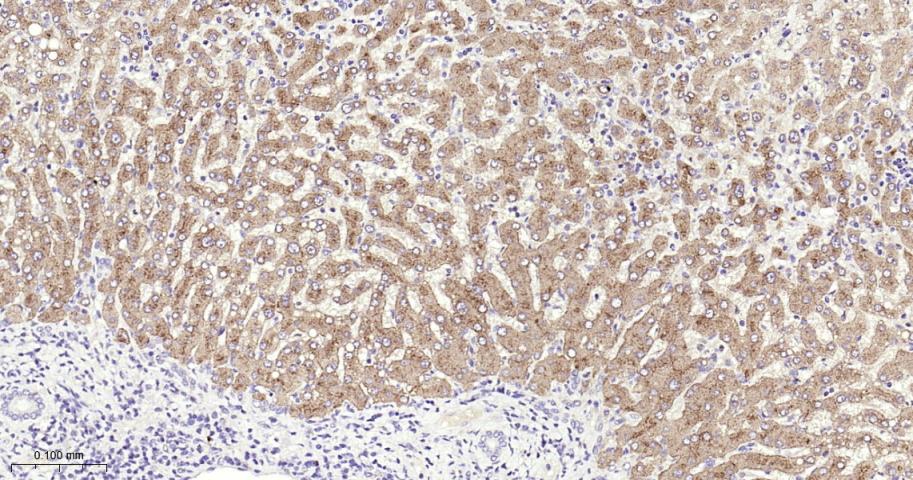 转铁蛋白受体2重组兔单抗
