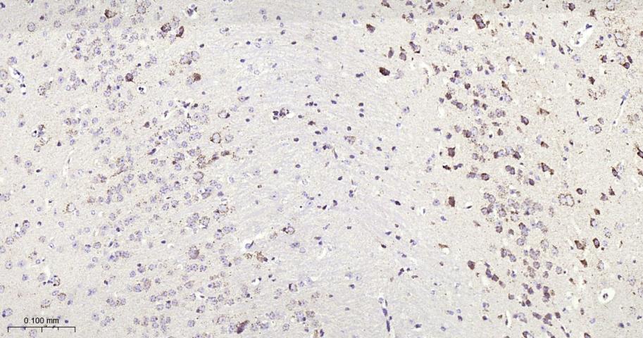 铁调节蛋白2重组兔单抗