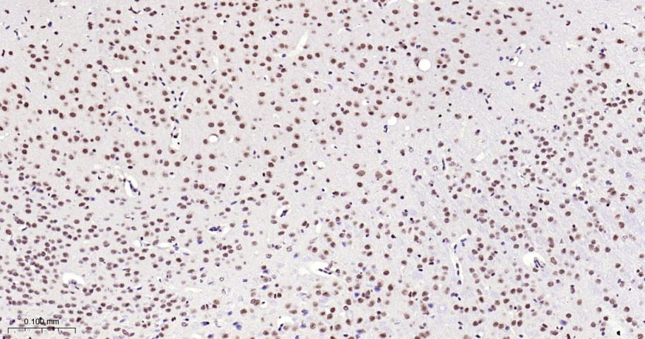 甲基转移酶样蛋白3重组兔单抗