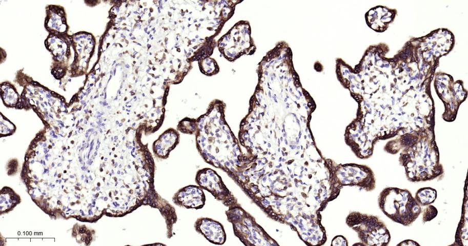 胰岛素样生长因子2mRNA结合蛋白3重组兔单抗