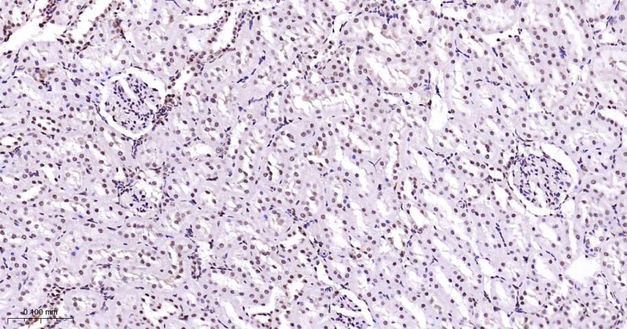 丝裂原活化蛋白激酶p38α重组兔单抗