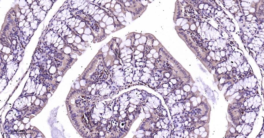 p38 MAPK重组兔单抗