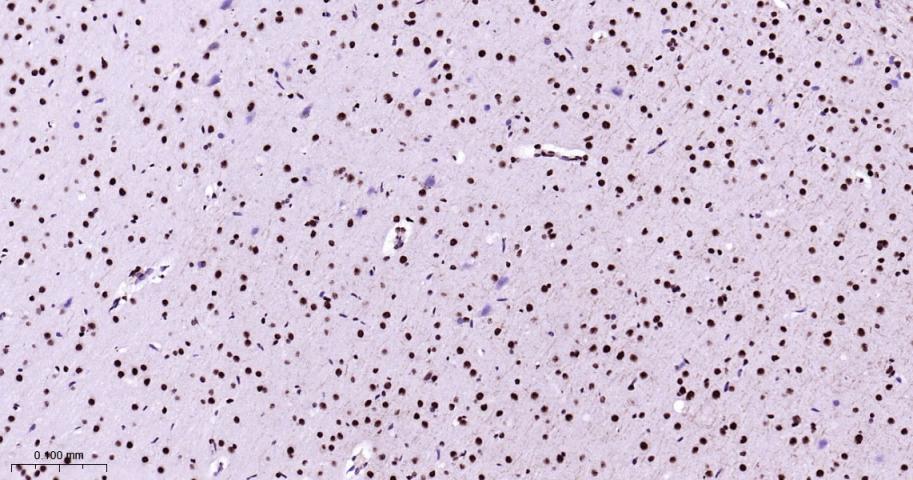 丝裂原活化蛋白激酶p38α重组兔单抗