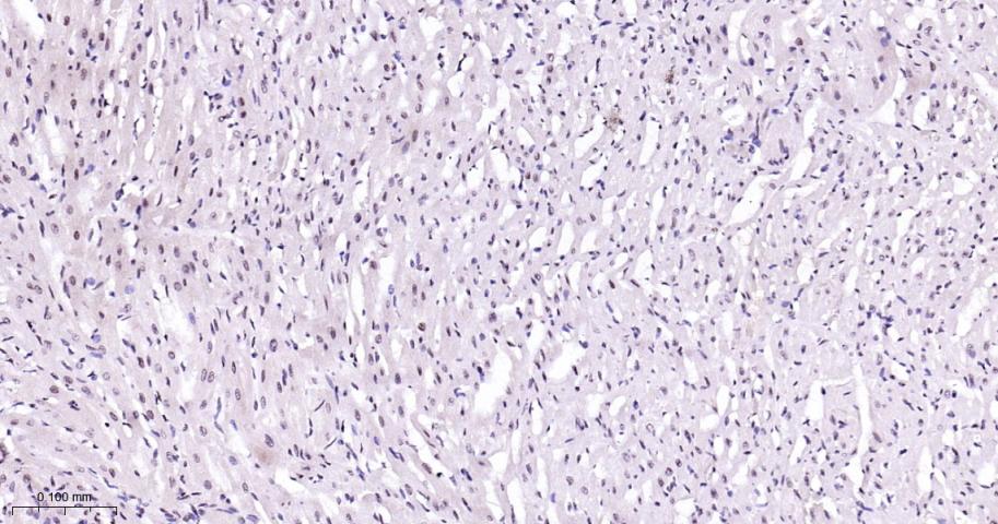 丝裂原活化蛋白激酶p38α重组兔单抗