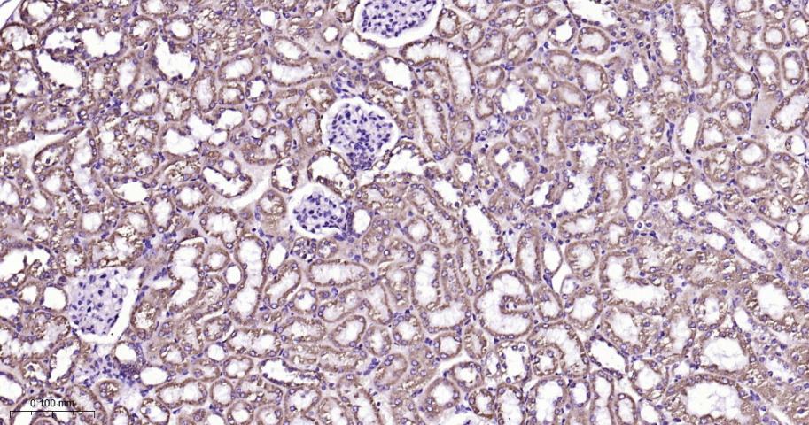 等电压依赖性阴离子通道（内参）重组兔单抗
