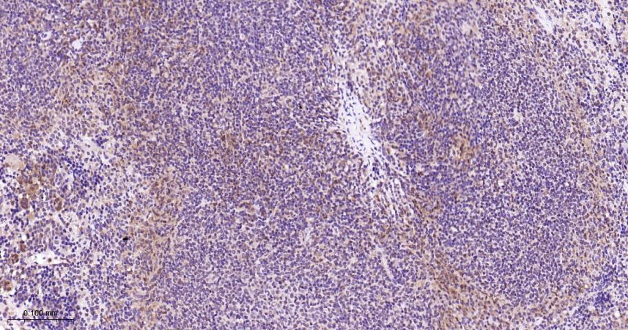 丝裂原活化蛋白激酶p38α重组兔单抗