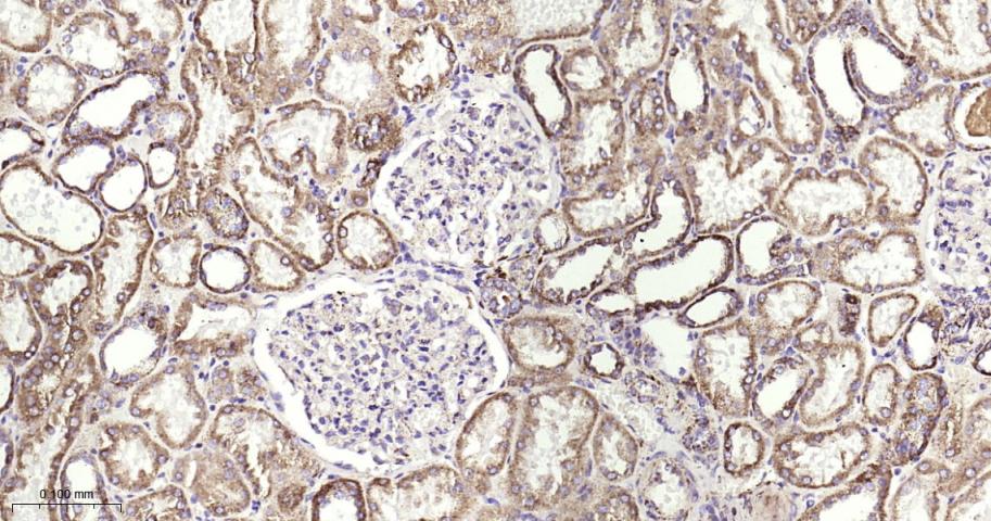 铁调节蛋白2重组兔单抗