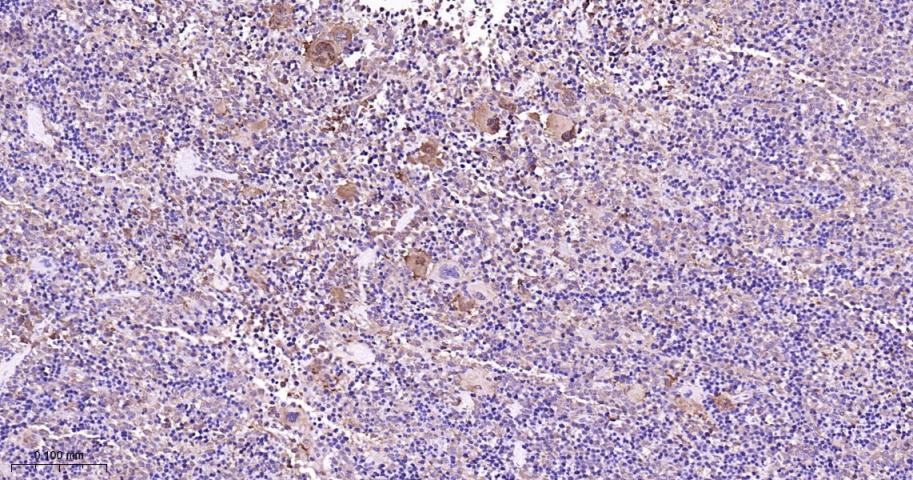 p38 MAPK重组兔单抗