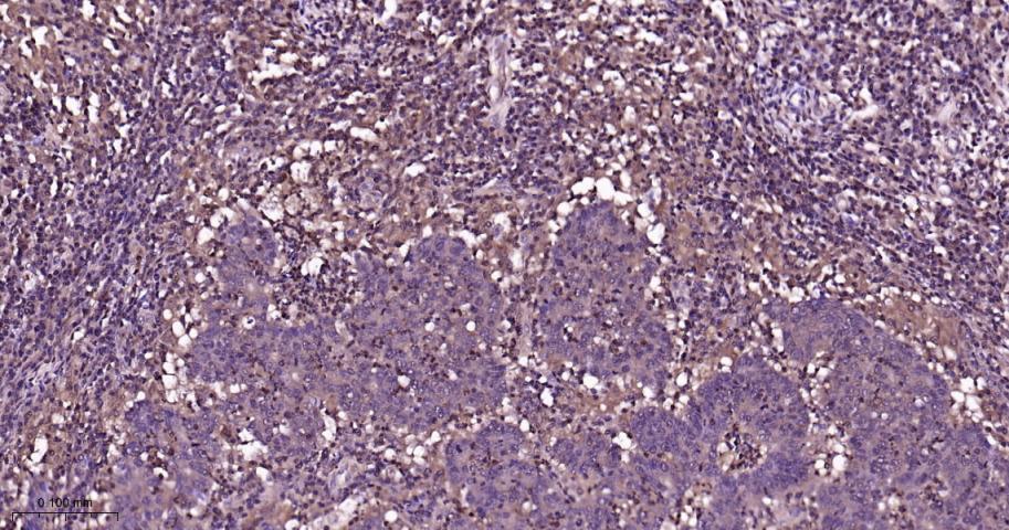 p38 MAPK重组兔单抗