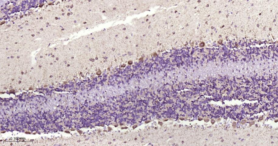铁调节蛋白2重组兔单抗