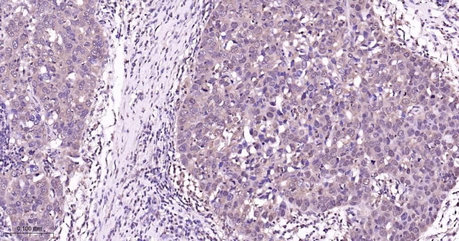 p38 MAPK重组兔单抗