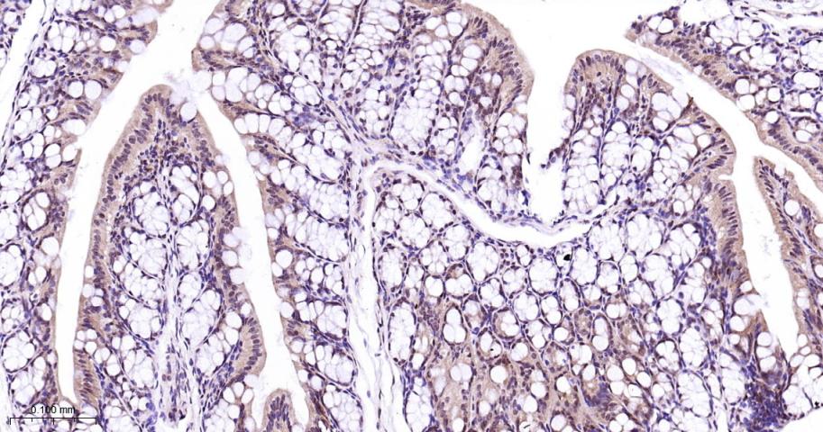 丝裂原活化蛋白激酶p38α重组兔单抗