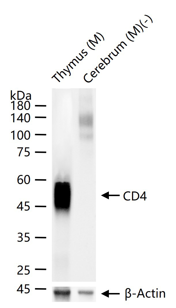 CD4重组兔单抗