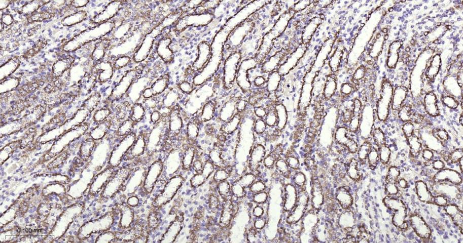 铁调节蛋白2重组兔单抗