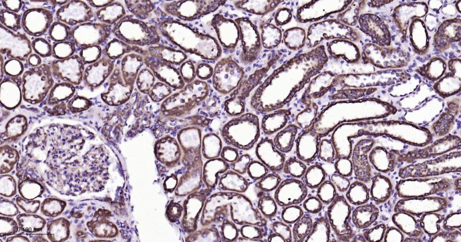 等电压依赖性阴离子通道（内参）重组兔单抗